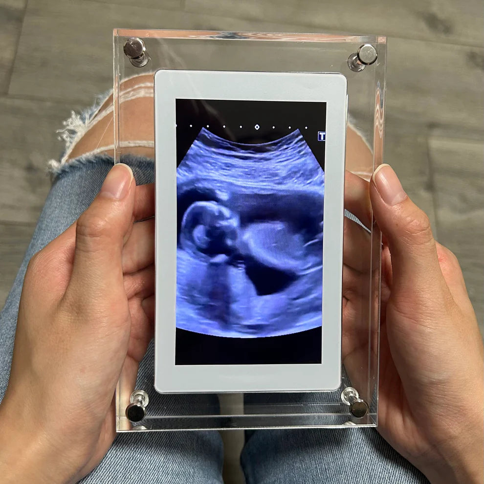 Tiny Treasure™ Digital Frame