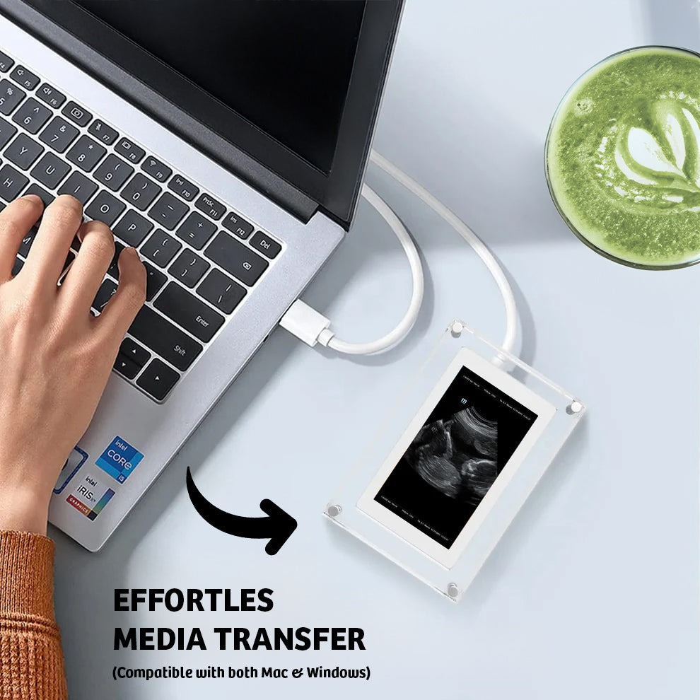 Tiny Treasure™ Digital Frame