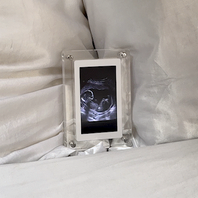 Tiny Treasure™ Digital Frame